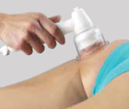 Vakuumska Kavitacija Sonic Shaper